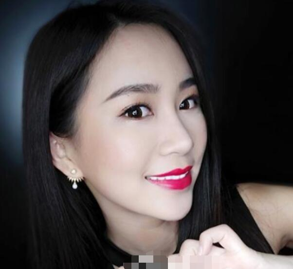 深圳鵬程整形劉冰做的鼻子真絕了，跟我想象的一模一樣