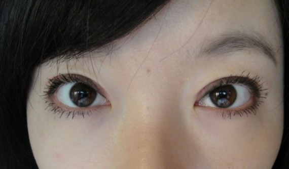 在鄭州望京做全切雙眼皮+開外眼角，術(shù)后效果確實(shí)沒讓我失望