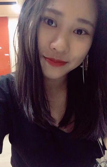 肇慶華美整形切開雙眼皮術(shù)后三個月效果分享，這不比貼雙眼皮香？