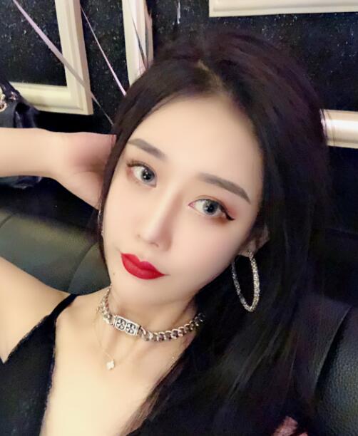 長沙亞韓整形陳明松下頜角整形術(shù)后三個月效果