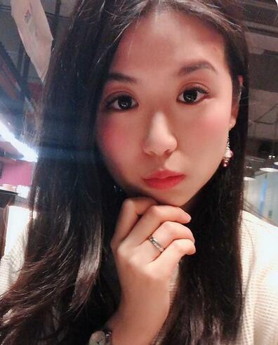 汕頭曙光整形皮秒激光祛斑一個(gè)月效果