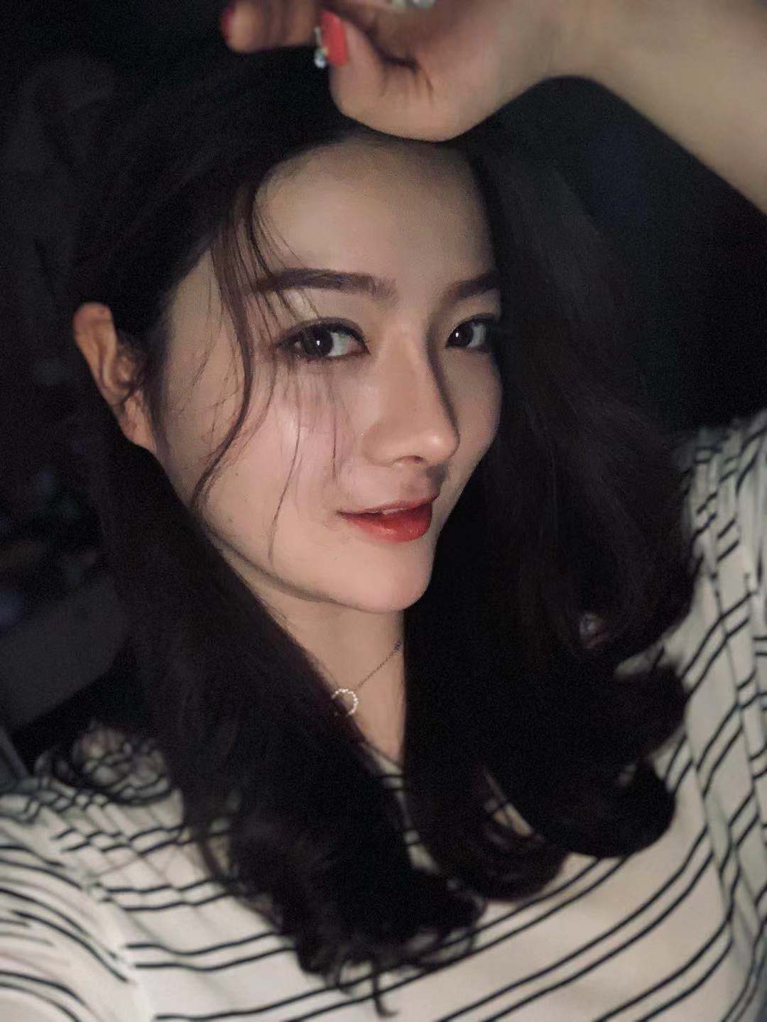 北京圣嘉榮二次鼻修復(fù)術(shù)后一個(gè)月