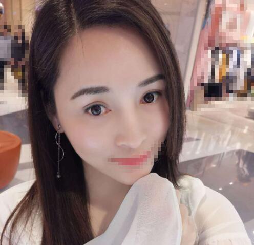 赤峰現(xiàn)代婦產(chǎn)醫(yī)院醫(yī)療美容科袁俊龍雙眼皮修復(fù)前效果