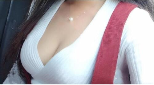 濟南悅美假體隆胸整形術(shù)后三個月效果分享