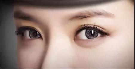 杭州迪美醫(yī)療美容門診部做開內(nèi)眼角術(shù)后效果