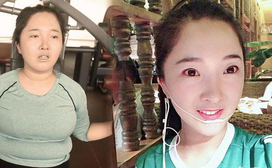 埋線減肥是什么？中醫(yī)診所里推出的埋線減肥真有用嗎，有科學(xué)依據(jù)嗎？