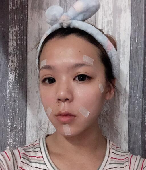 治療前