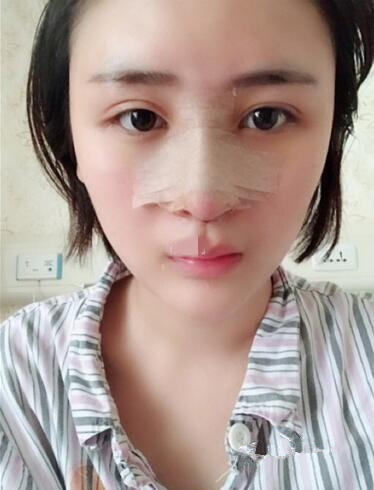術(shù)中效果
