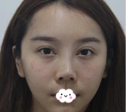 手術(shù)前的準備