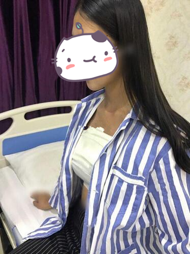 北京冰蝶醫(yī)療整形張克旭琴面假體隆胸案例，隆胸效果對比圖