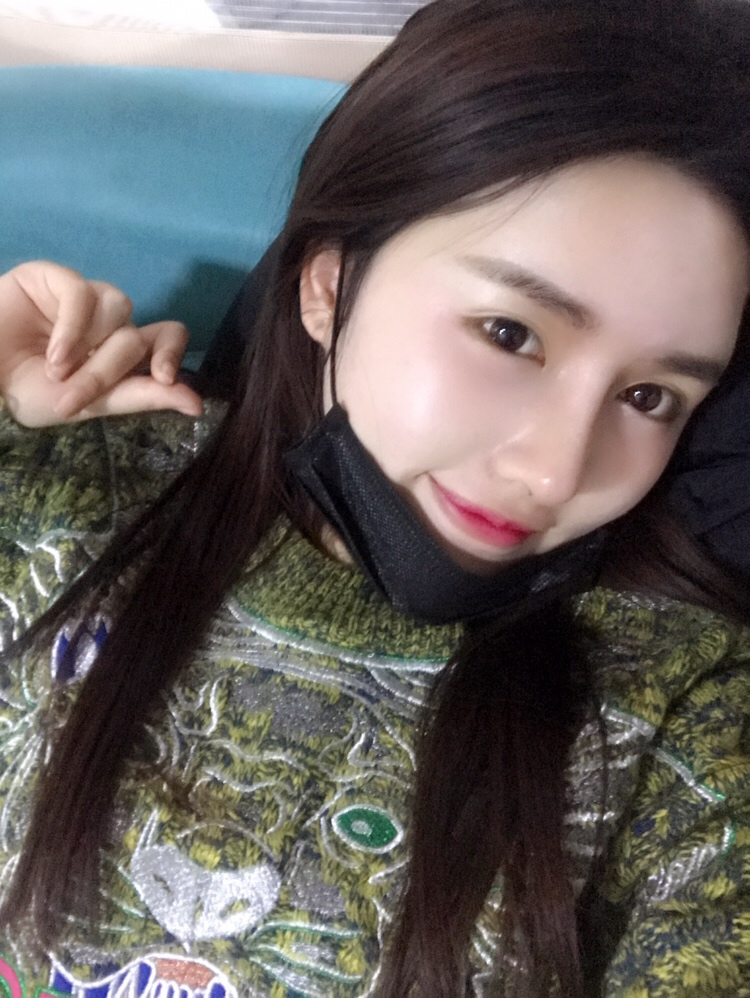 北京星美李寧輝進口膨體隆鼻案例效果對比圖，鼻子自然又美麗