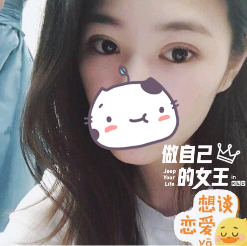 做完雙眼皮手術(shù)恢復(fù)后的樣子