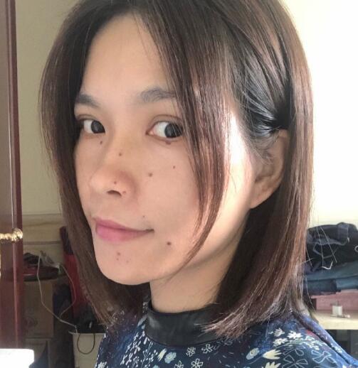 廖苑利光子嫩膚案例效果展示：