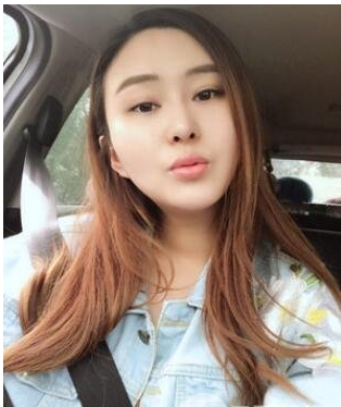 雙美膠原蛋白注射豐唇效果