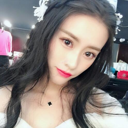 長春銘妍醫(yī)療美容門診部做雙眼皮怎么樣？長春銘妍雙眼皮案例分享