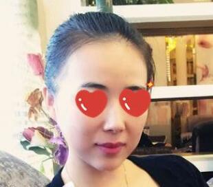上海美萊醫(yī)療美容門診部伊維蘭隆下巴的優(yōu)勢(shì)