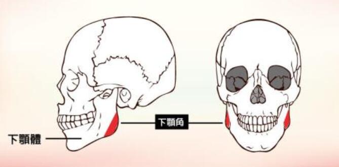 女人后縮下頜角整形介紹