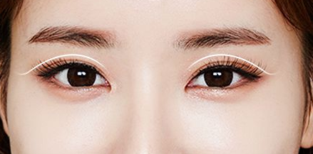 廈門(mén)張銘整醫(yī)療美容診所激光祛眼袋