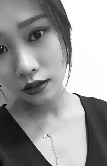 上海伊美爾港華整形醫(yī)生師麗麗做雙眼皮怎么樣？師麗麗雙眼皮案例分享