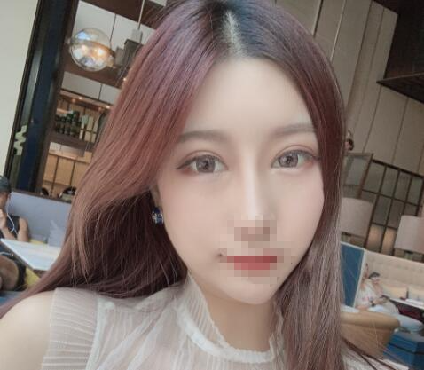 北京彤美整形醫(yī)院專家李長賦做鼻部綜合整形怎么樣？