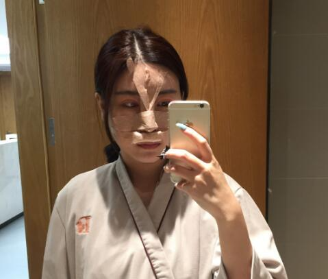 北京彤美整形醫(yī)院專家李長賦做鼻部綜合整形怎么樣？