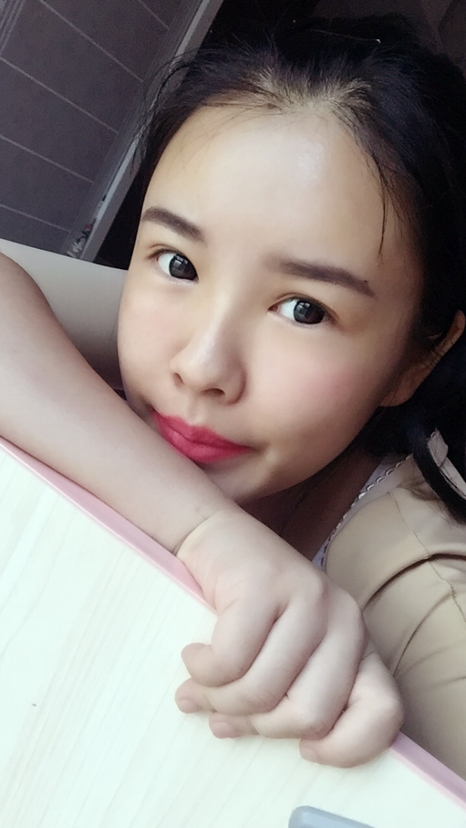 西安莎曼妃醫(yī)療美容醫(yī)院醫(yī)生樸俊做自體脂肪豐太陽穴效果怎么樣？