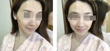 恢復(fù)過程