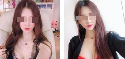 沈陽杏林整形美容醫(yī)院崔昌墉醫(yī)生做假體隆胸技術(shù)怎么樣？附案例