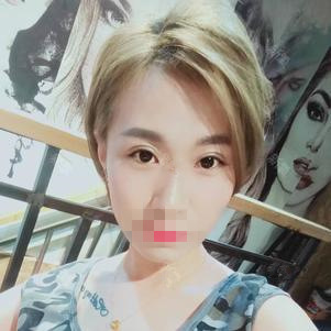 上海臻景醫(yī)療整形醫(yī)生李載成做雙眼皮怎么樣？李載成雙眼皮手術(shù)案例