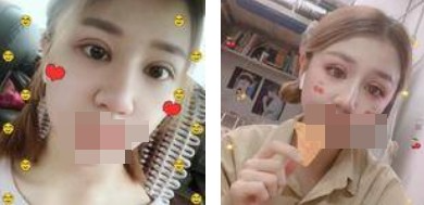 做了全切雙眼皮不僅外表變美了，內(nèi)心也更加自信了