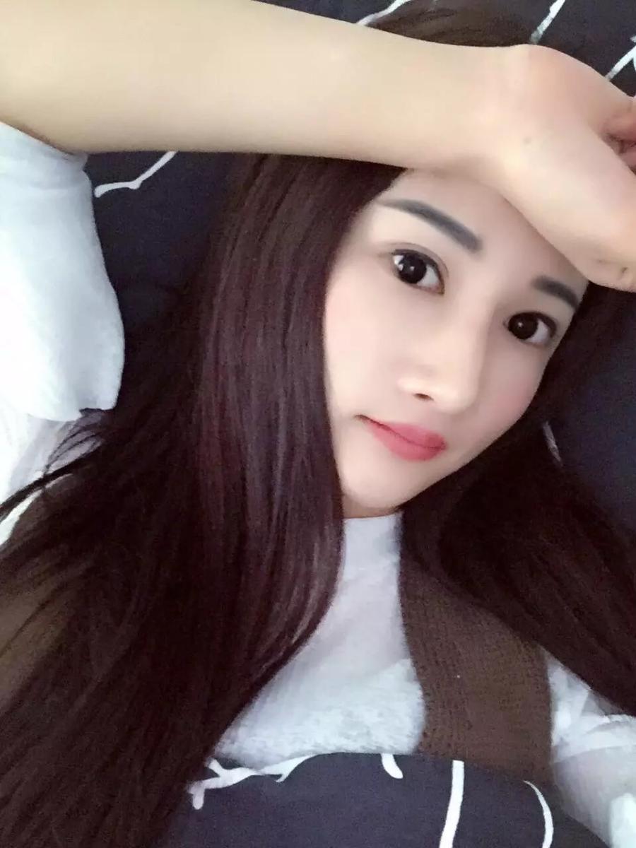 廣州廣大整形醫(yī)生秦瑜做顴骨內(nèi)推+下頜角整形怎么樣？附案例