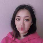 做完雙眼皮手術(shù)眼睛更加迷人了，眼睛自己會(huì)撩小哥哥