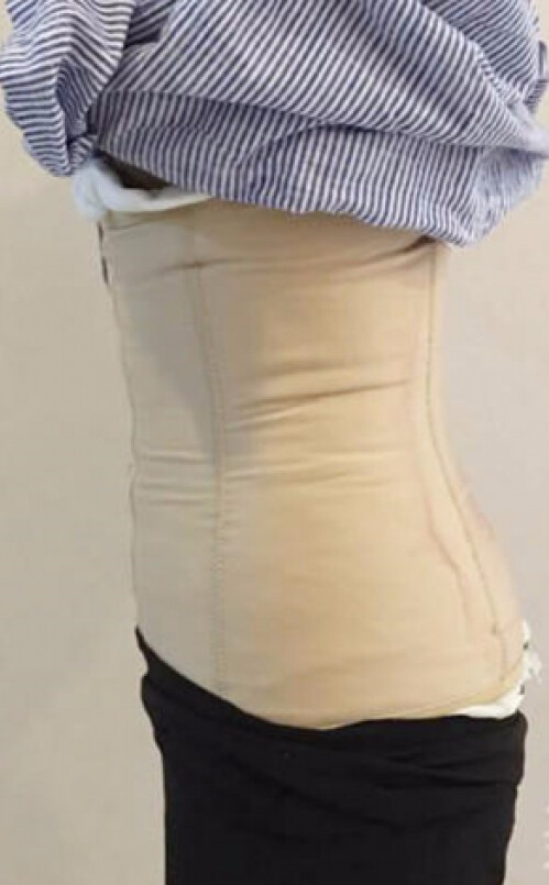 合肥壹加壹整形醫(yī)生周福田做腰腹吸脂技術(shù)怎么樣？附腰腹吸脂案例