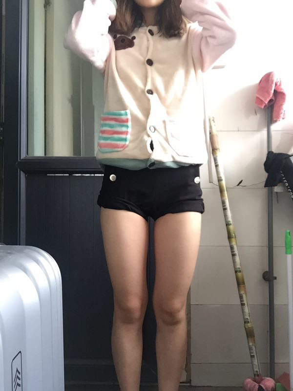 成都美立方整形醫(yī)院黃華醫(yī)生做大腿吸脂怎么樣？附大腿吸脂案例