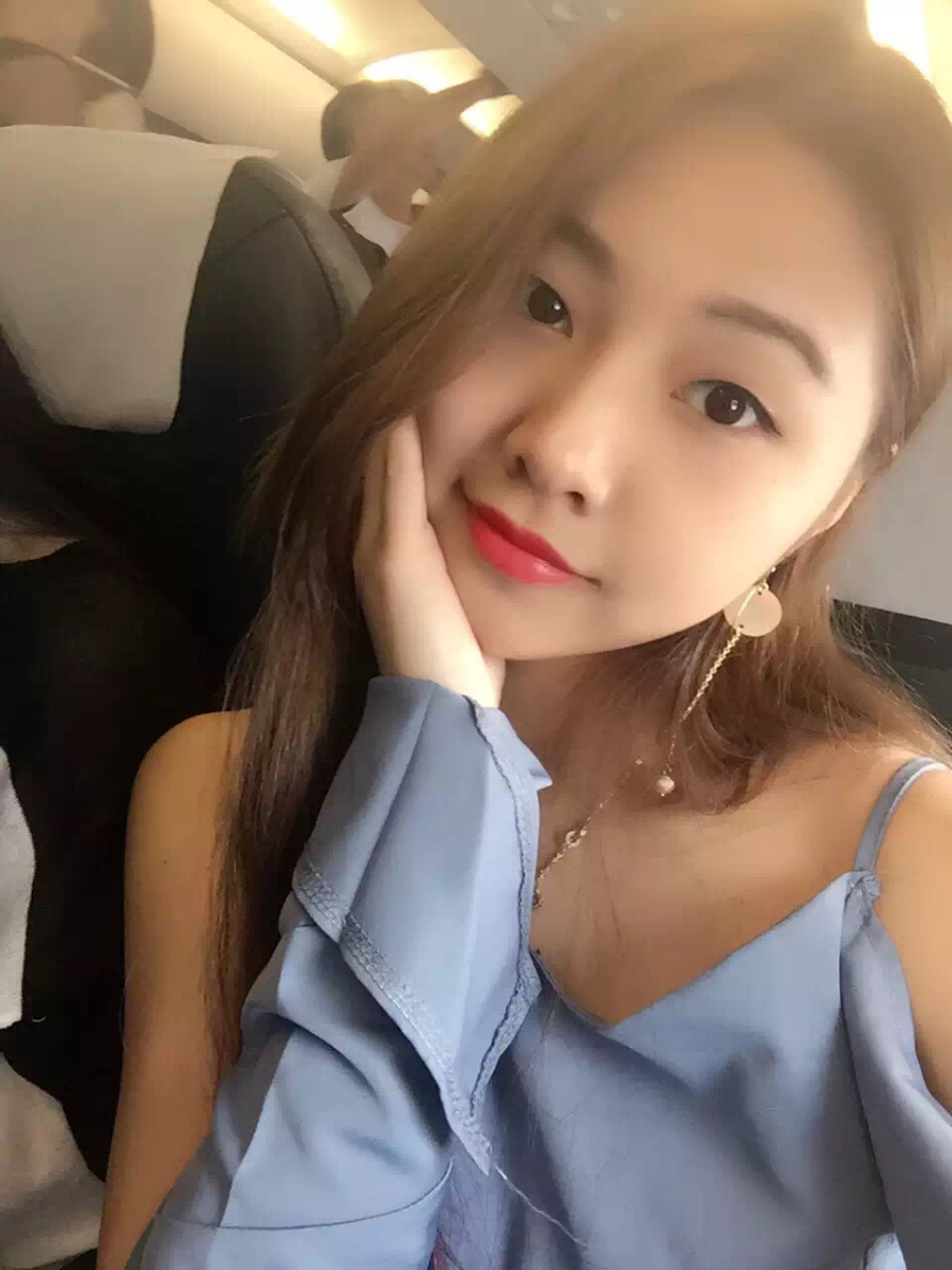 廣州中科美整形醫(yī)生徐長亮做切開雙眼皮怎么樣？附切開雙眼皮案例