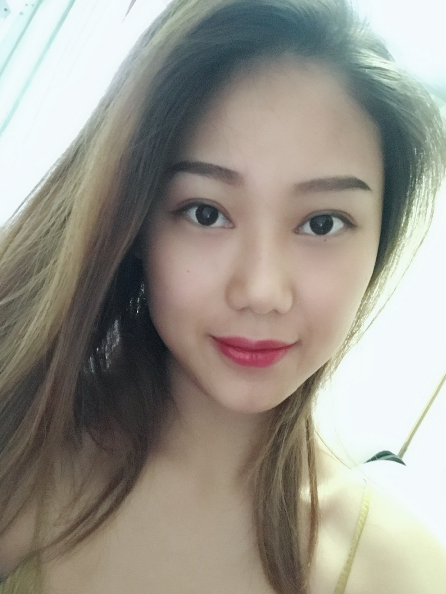 西安藝星整形醫(yī)院徐智慧醫(yī)生做埋線提升怎么樣？附西安藝星埋線提升案例