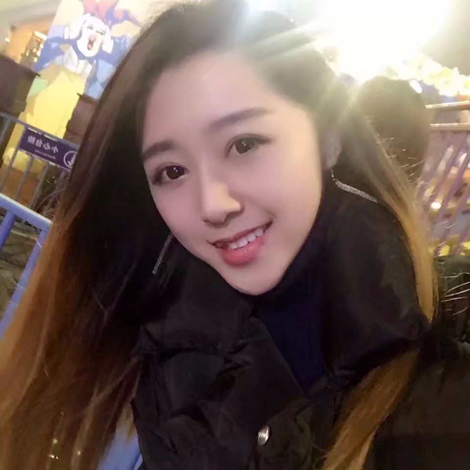 西安米蘭柏羽整形醫(yī)院李旭平做切開雙眼皮效果怎么樣？附案例