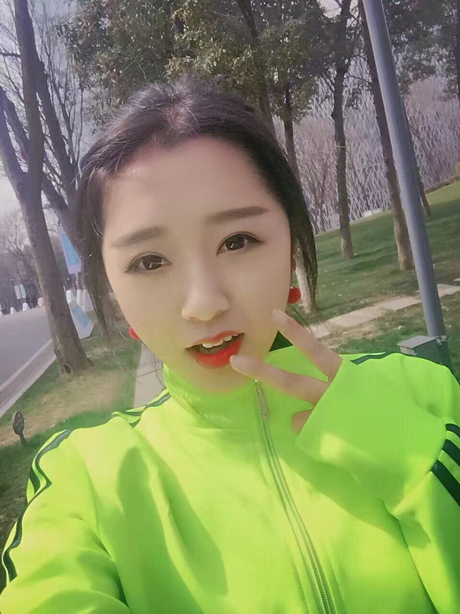 西安米蘭柏羽整形醫(yī)院李旭平做切開雙眼皮效果怎么樣？附案例