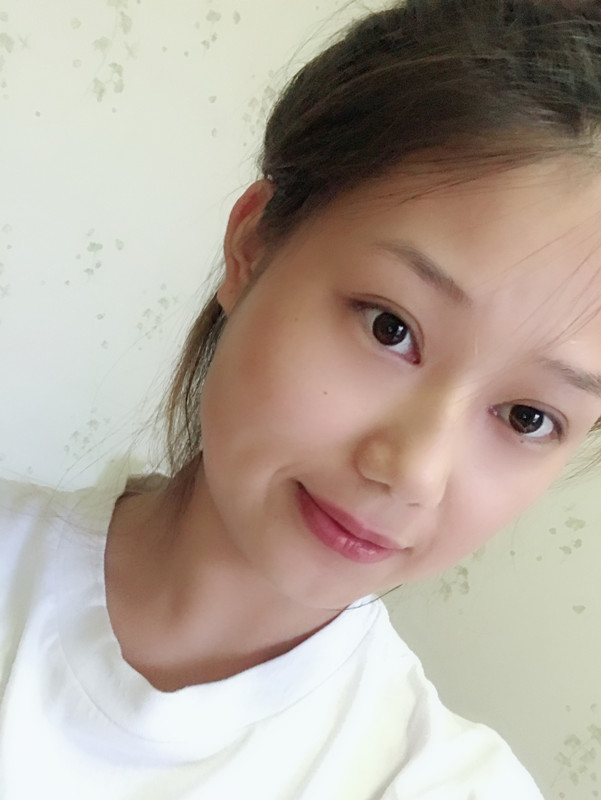 西安藝星整形醫(yī)院徐智慧醫(yī)生做埋線提升怎么樣？附西安藝星埋線提升案例
