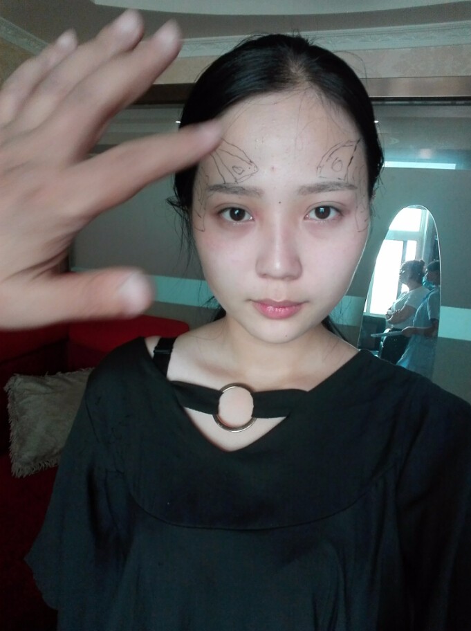 西安華仁醫(yī)院整形美容中心做自體脂肪填充效果怎么樣？附耿延鵬整形案例