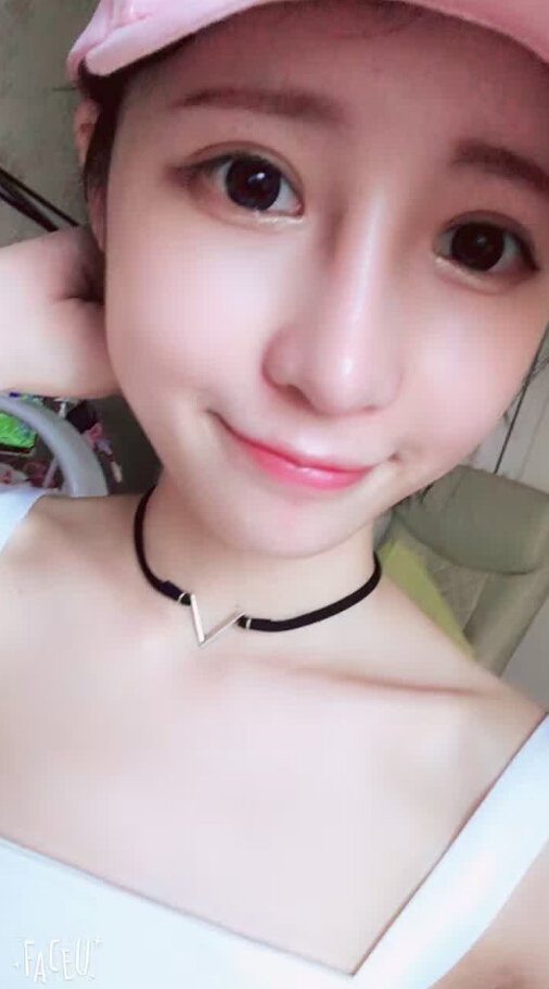 長(zhǎng)沙愛(ài)思特整形醫(yī)院陳星光醫(yī)生做鼻部多項(xiàng)+自體脂肪隆鼻+切開(kāi)雙眼皮+開(kāi)外眼角案例