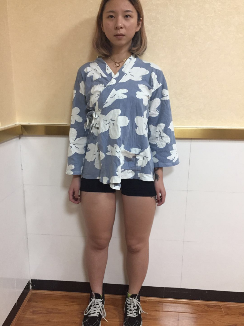 深圳鵬愛醫(yī)療整形醫(yī)生張建文做大腿吸脂怎么樣？附大腿吸脂案例效果對(duì)比圖
