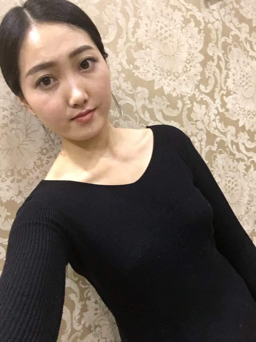 宜春美萊醫(yī)療整形醫(yī)生黃治林做自體脂肪隆胸怎么樣？附案例