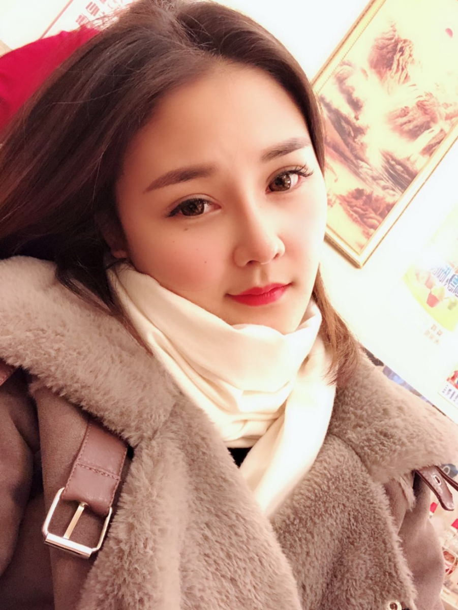 鄭州華領(lǐng)醫(yī)療美容醫(yī)院賀小虎醫(yī)生做眼綜合+鼻部整形手術(shù)效果怎么樣？