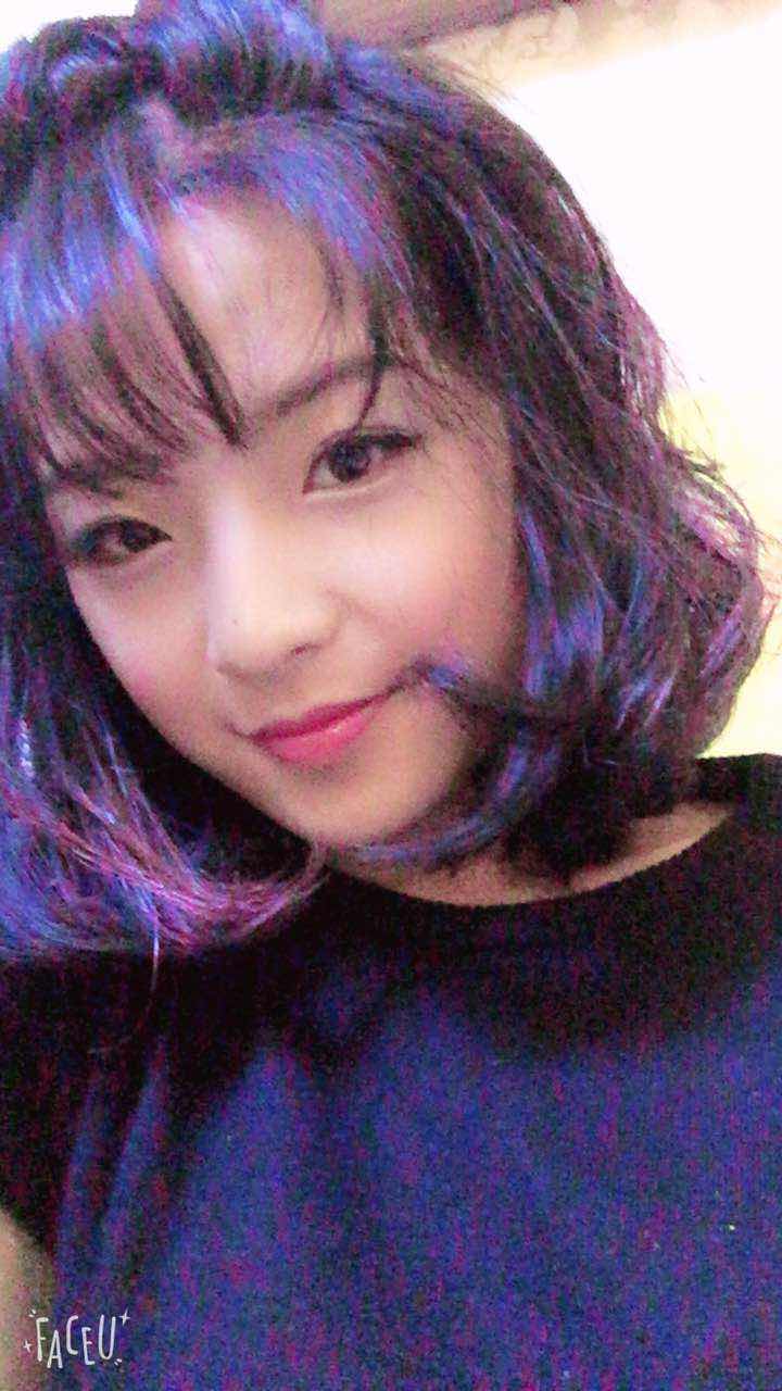 鄭州名門整形醫(yī)院董斌醫(yī)生做下頜角整形怎么樣？附下頜角整形案例