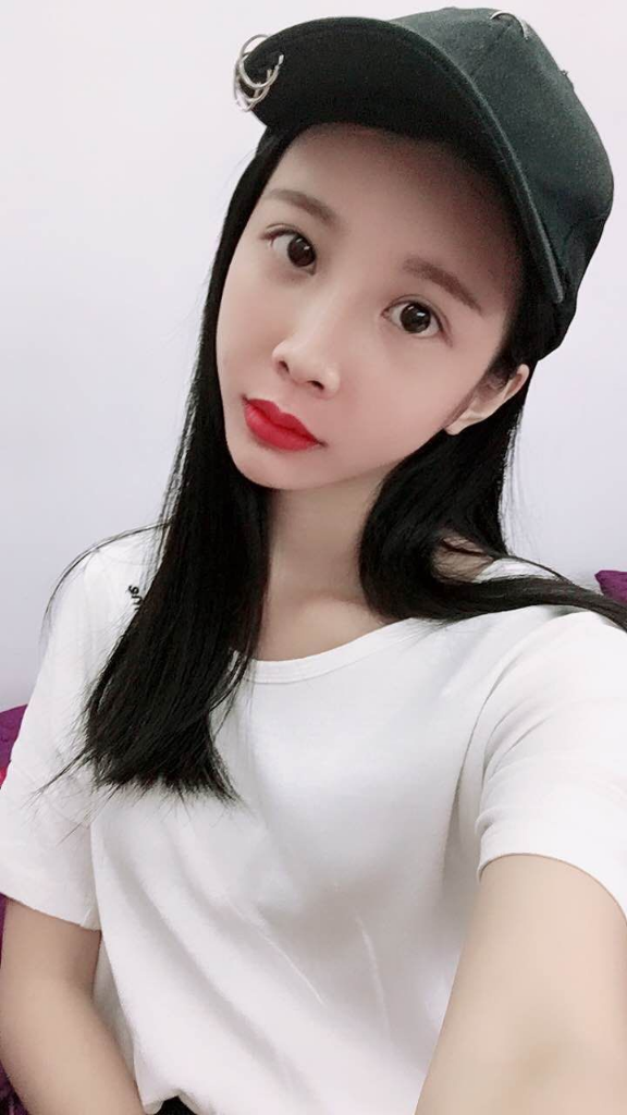 西安高一生醫(yī)療美容醫(yī)院網(wǎng)購恒醫(yī)生做自體脂肪全臉填充案例效果對比圖