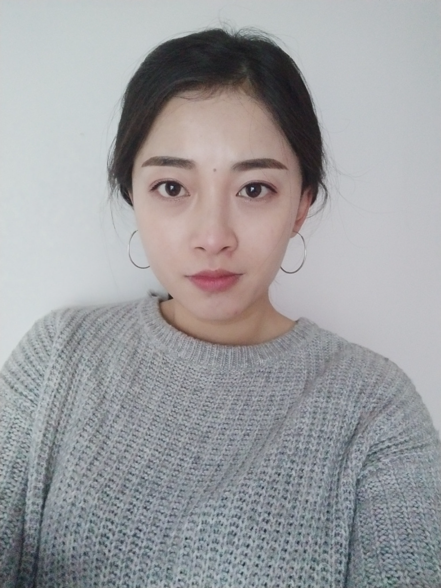 重慶當代整形李敏旭醫(yī)生做皮秒激光祛斑效果怎么樣？附皮秒激光祛斑案例