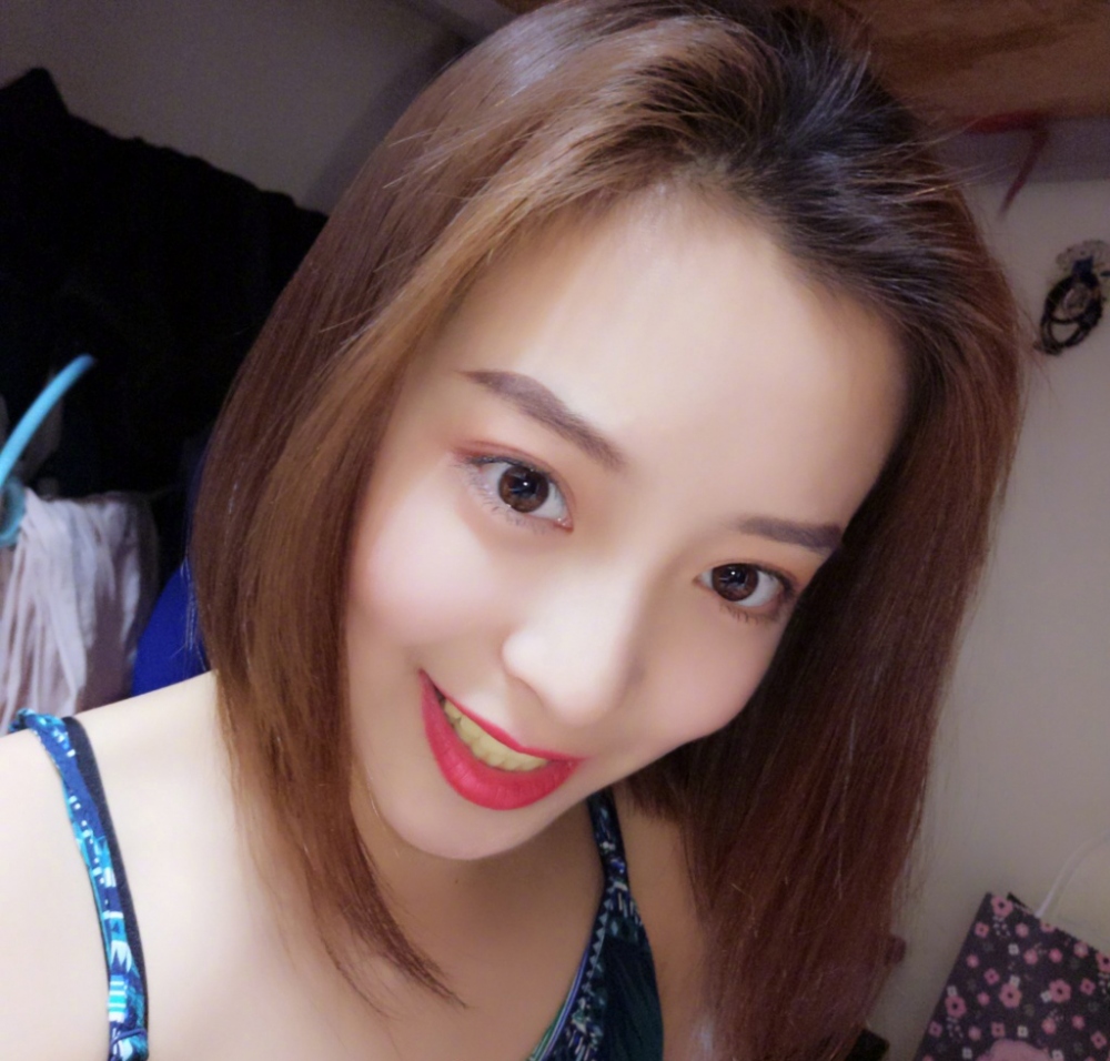重慶樂樂欣口腔趙麗麗醫(yī)生做冷光美白效果怎么樣？附冷光美白效果對比圖