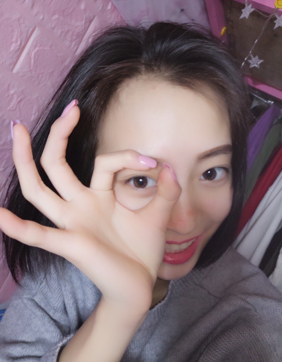 重慶樂樂欣口腔趙麗麗醫(yī)生做冷光美白效果怎么樣？附冷光美白效果對比圖