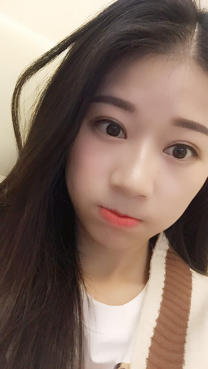 深圳晨曦醫(yī)療整形醫(yī)生吉米斯做切開(kāi)雙眼皮怎么樣？吉米斯切開(kāi)雙眼皮案例效果
